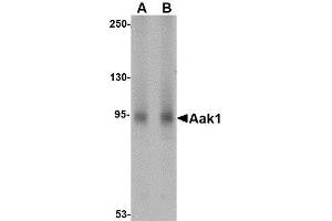 Western blot analysis of Aak1 in A-20 lysate with AP30003PU-N Aak1 antibody at (A) 1 and (B) 2 μg/ml. (AAK1 抗体  (N-Term))