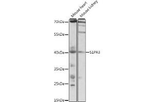 Western blot analysis of extracts of various cell lines, using S1PR3 antibody (ABIN7270535) at 1:1000 dilution. (S1PR3 抗体  (AA 100-200))