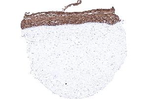 Uterus ectocervix (Recombinant Keratin 6 抗体)