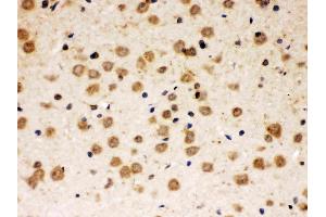 Immunohistochemistry (IHC) image for anti-Active BCR-Related (ABR) (AA 370-407), (Middle Region) antibody (ABIN4886413)