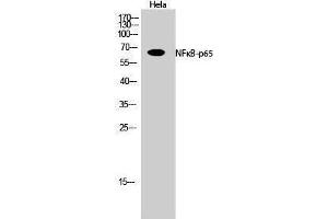 Western Blotting (WB) image for anti-Nuclear Factor-kB p65 (NFkBP65) (Thr72) antibody (ABIN3176327) (NF-kB p65 抗体  (Thr72))