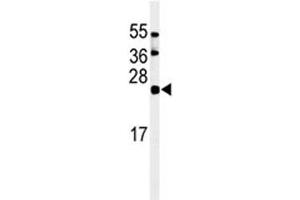 Western blot analysis of ISG15 antibody and HL-60 lysate (ISG15 抗体  (AA 136-165))