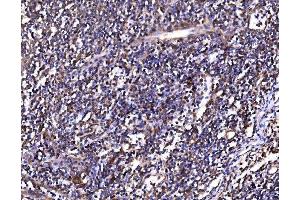 IHC analysis of PSMD8 using anti-PSMD8 antibody (ABIN7602571).