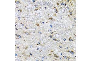 Immunohistochemistry of paraffin-embedded mouse spinal cord using BLZF1 antibody (ABIN2561429) at dilution of 1:100 (40x lens). (BLZF1 抗体)