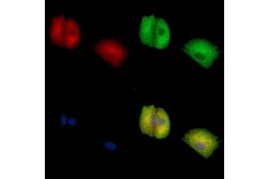 ABIN7096887 and ABIN7100953 staining  cells by IF/ICC. (C21orf91 抗体)
