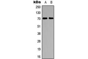 Western blot analysis of S6K1 expression in HeLa (A), HepG2 (B) whole cell lysates.