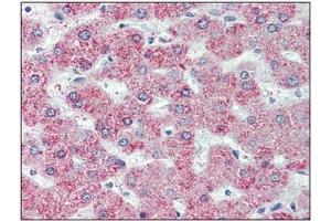 Immunohistochemistry: GPR146 antibody staining of Formalin-Fixed, Paraffin-Embedded Human Liver. (GPR146 抗体  (Internal Region))