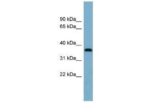 WB Suggested Anti-NEURL2 Antibody Titration: 0. (NEURL2 抗体  (Middle Region))
