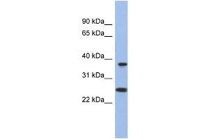 WB Suggested Anti-MTRF1L Antibody Titration: 0. (MTRF1L 抗体  (N-Term))