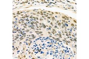 Immunohistochemistry (Paraffin-embedded Sections) (IHC (p)) image for anti-Poly A Binding Protein Nuclear 1 (PABPN1) antibody (ABIN7075116)
