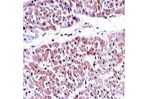 PTEN antibody immunohistochemistry analysis in formalin fixed and paraffin embedded human heart tissue. (PTEN 抗体  (AA 264-295))