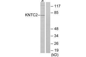 Western blot analysis of extracts from Jurkat cells, using KNTC2 antibody. (NDC80 抗体  (Internal Region))