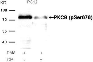 Western blot analysis of extracts from PC12 cells, treated with PMA or calf intestinal phosphatase (CIP), using PKCθ (Phospho-Ser676) Antibody. (PKC theta 抗体  (pSer676))
