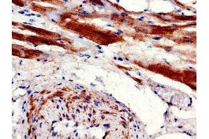 Immunohistochemistry of paraffin-embedded human heart tissue using ABIN7146837 at dilution of 1:100 (CPT1B 抗体  (AA 165-318))