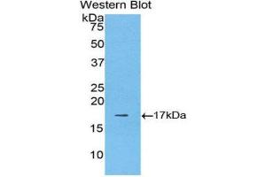 Western Blotting (WB) image for anti-Lectin, Galactoside-Binding, Soluble, 9B (LGALS9B) (AA 17-148) antibody (ABIN1171885) (LGALS9B 抗体  (AA 17-148))