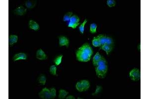 Immunofluorescence staining of MCF-7 cells with ABIN7152879 at 1:333, counter-stained with DAPI. (FANK1 抗体  (AA 1-345))