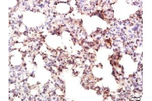 Paraformaldehyde-fixed, paraffin embedded rat lung tissue, Antigen retrieval by boiling in sodium citrate buffer(pH6) for 15min, Block endogenous peroxidase by 3% hydrogen peroxide for 30 minutes, Blocking buffer (normal goat serum) at 37°C for 20min, Antibody incubation with Rabbit Anti-IRF7 Polyclonal Antibody, Unconjugated  at 1:400 overnight at 4°C, followed by a conjugated secondary and DAB staining (IRF7 抗体  (AA 401-503))
