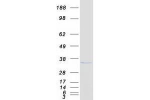 Western Blotting (WB) image for CTD (Carboxy-terminal Domain, RNA Polymerase II, Polypeptide A) Small Phosphatase 1 (CTDSP1) (Transcript Variant 2) protein (Myc-DYKDDDDK Tag) (ABIN2712604)
