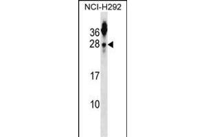 TSN2 Antibody (N-term) (ABIN1539218 and ABIN2848532) western blot analysis in NCI- cell line lysates (35 μg/lane). (Tetraspanin 2 抗体  (N-Term))