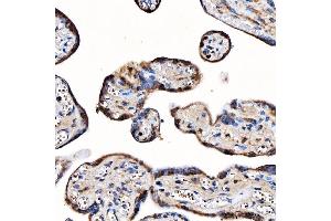 IHC analysis of TOP3B using anti-TOP3B antibody (ABIN7599907). (TOP3B 抗体  (AA 128-824))