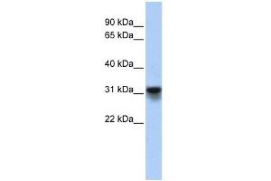 KDELR3 antibody used at 1 ug/ml to detect target protein. (KDELR3 抗体)