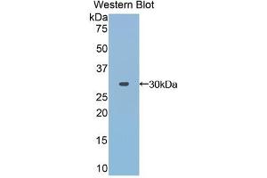 Western blot analysis of the recombinant protein. (TOLLIP 抗体  (AA 28-261))