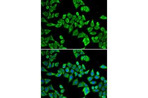 Immunofluorescence analysis of HeLa cells using DDX20 antibody. (DDX20 抗体)