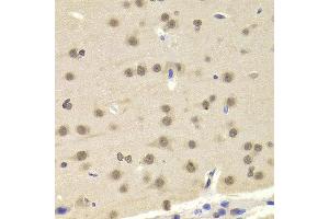 Immunohistochemistry of paraffin-embedded Mouse brain using ETV7 antibody at dilution of 1:100 (x400 lens). (ETV7 抗体)