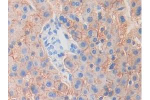 DAB staining on IHC-P; Samples: Human Liver Tissue (MYO1G 抗体  (AA 769-1016))