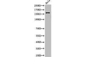 Western Blot analysis of HeLa cells using Cleaved-Spectrin α II (D1185) Polyclonal Antibody (SPTAN1 抗体  (Cleaved-Asp1185))