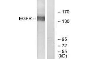 Western blot analysis of extracts from A431 cells, treated with EGF 40myM 10', using EGFR (Ab-869) Antibody. (EGFR 抗体  (AA 836-885))