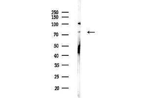 anti-Calpain 10 (CAPN10) (N-Term) antibody