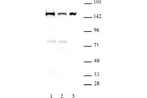 DHX9 antibody (mAb) (Clone 8E3) tested by Western blot. (DHX9 抗体  (N-Term))
