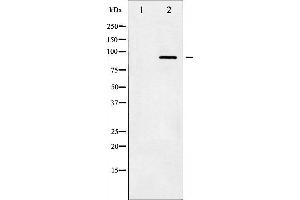 Western blot analysis of IKK- beta phosphorylation expression in TNF-a treated HeLa whole cell lysates,The lane on the left is treated with the antigen-specific peptide. (IKBKB 抗体  (pTyr199))