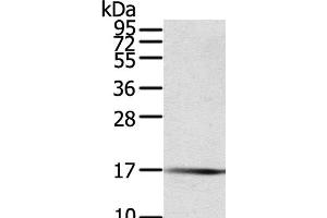 Western Blot analysis of Human fetal muscle tissue using PTPMT1 Polyclonal Antibody at dilution of 1:200 (PTPMT1 抗体)