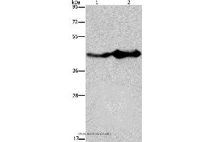 Western blot analysis of Mouse liver and brain tissue, using GLUL Polyclonal Antibody at dilution of 1:600 (GLUL 抗体)