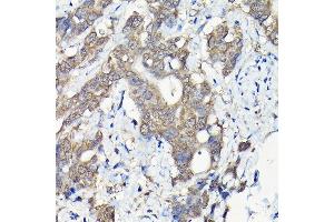 Immunohistochemistry of paraffin-embedded mouse testis using PIWIL4 Rabbit pAb (ABIN6132982, ABIN6145704, ABIN6145705 and ABIN6217111) at dilution of 1:100 (40x lens). (PIWIL4 抗体  (AA 260-460))