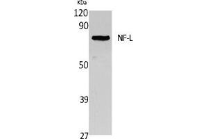 Western Blot analysis of extracts from Jurkat cells, using NF-L Polyclonal Antibody. (NEFL 抗体  (C-Term))