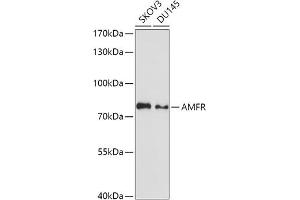 Western blot analysis of extracts of various cell lines, using AMFR antibody (ABIN1678650, ABIN3018012, ABIN3018013 and ABIN6220335) at 1:1000 dilution. (AMFR 抗体  (AA 384-643))