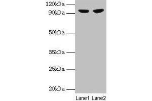 Western blot All lanes: PYGL antibody at 2 μg/mL Lane 1: 293T whole cell lysate Lane 2: HepG2 whole cell lysate Secondary Goat polyclonal to rabbit IgG at 1/10000 dilution Predicted band size: 98, 94 kDa Observed band size: 98 kDa (PYGL 抗体  (AA 2-846))
