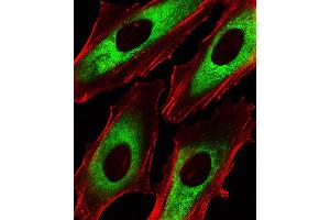 Fluorescent image of Hela cells stained with EEF1B2 Antibody . (EEF1B2 抗体  (AA 54-86))