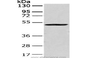 Western Blot analysis of 293T cell using CRTAM Polyclonal Antibody at dilution of 1:250 (CRTAM 抗体)