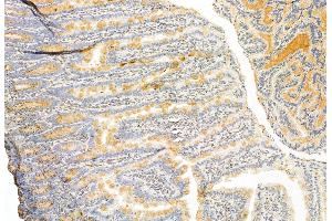 ABIN6262482 and ABIN6272876 at 1/100 staining Rat colon tissue by IHC-P. (IFT81 抗体  (Internal Region))