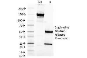 SDS-PAGE Analysis Purified MAML2 Monoclonal Antibody (MAML2/1302). (MAML2 抗体)