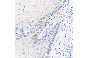 Immunohistochemistry (IHC) image for anti-Microtubule-Associated Protein 1 Light Chain 3 beta (MAP1LC3B) antibody (ABIN7268519)