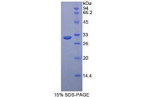 SDS-PAGE analysis of Mouse ASK1 Protein. (ASK1 蛋白)