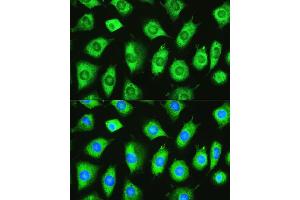 Immunofluorescence analysis of L929 cells using YTHDF1 Rabbit pAb  at dilution of 1:100. (YTHDF1 抗体)