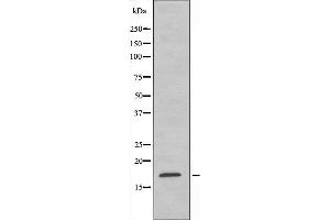 Western blot analysis of extracts from Jurkat cells, using RPS15 antibody. (RPS15 抗体  (C-Term))