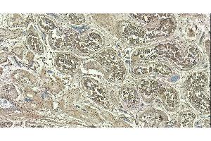Immunohistochemistry (IHC) image for anti-Myosin Phosphatase, Target Subunit 1 (PPP1R12A) (C-Term) antibody (ABIN6391349)