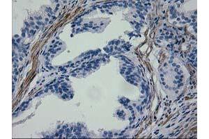 Immunohistochemical staining of paraffin-embedded Human prostate tissue using anti-ERBB2 mouse monoclonal antibody. (ErbB2/Her2 抗体  (AA 676-1255))